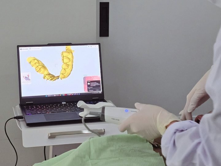 Three-dimensional intraoral scan of dental arch on a laptop screen during a consultation at DevelopDent Dental Clinic in Makati